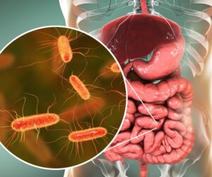 Symptoms of Parasitic Infections
