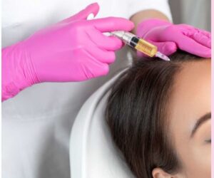 PRP Hair Treatment Oakville