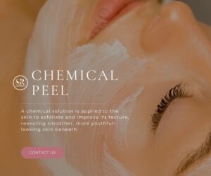 Chemical Peel Oakville