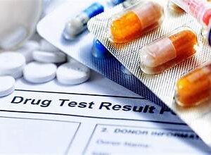 Drug Abuse Testing Market Analysis And Growth Forecast 2024-2032