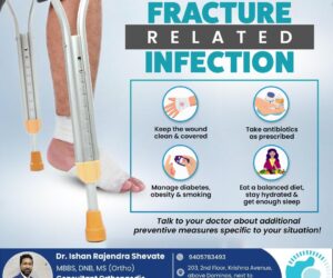 Prevention of Fracture-Related Infections: A Guide to Better Recovery