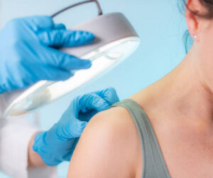 Smooth Skin: Top Benefits of Laser Hair Removal Treatments in 2025