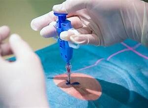 United States Biopsy Market Analysis And Growth Forecast 2023-2028