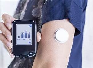 United States Diabetes Device Market Analysis And Growth Forecast 2024-2032