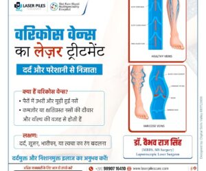 Understanding Varicose Veins and Their Laser Treatment