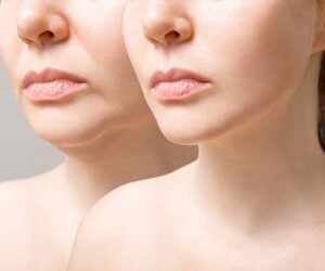 Why Is Facial Rejuvenation So Popular?