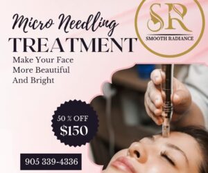 IPL Treatments