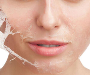Aesthetic World offers the Best Organic Fruit Peels for Skin in Amritsar.