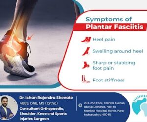 Understanding Plantar Fasciitis: Symptoms and Solutions – Dr. Ishan Shevate – Orthopaedic surgeon