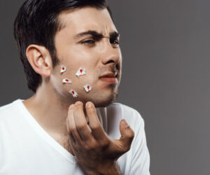 Best Acne Treatment in Amritsar: Your Path to Clear and Healthy Skin