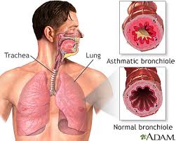 Guide to Treating Asthma and Allergic Rhinitis Symptoms