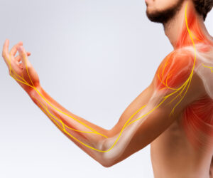 Migraine-Associated Pain: Can Aspadol 100 mg (Tapentadol) Offer Relief?